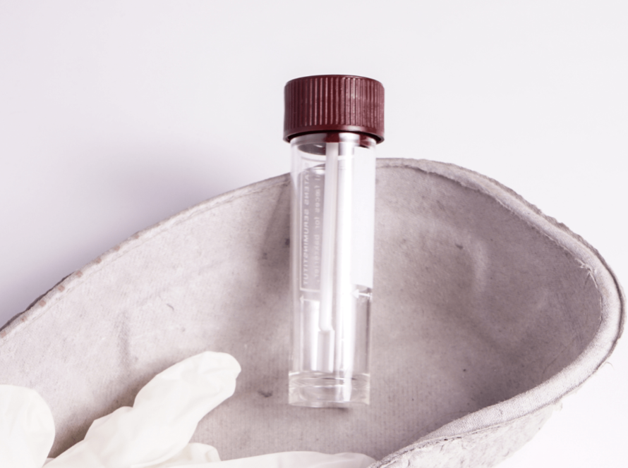 Stool sample test tube with white gloves beside